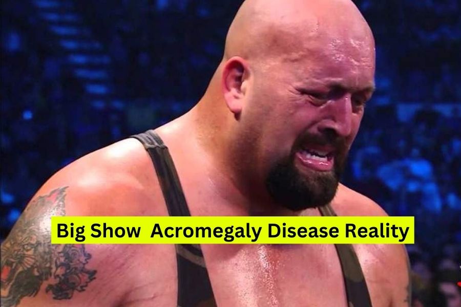 WWE Big Show Acromegaly Disease Problem